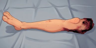 Fake Severed Leg Cartoon