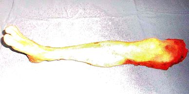 Fake Severed Leg
