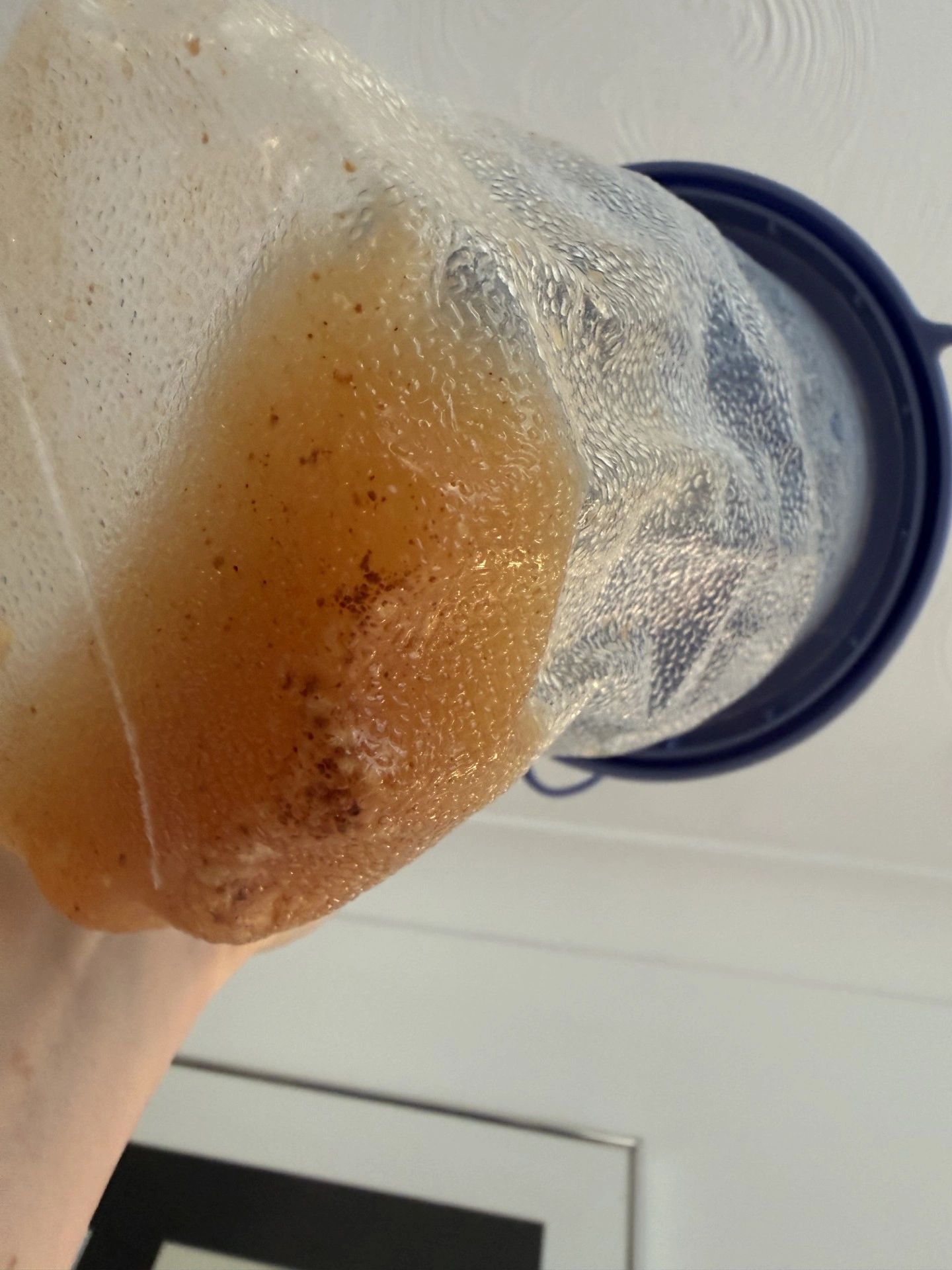 Ear wax removal result — example 8