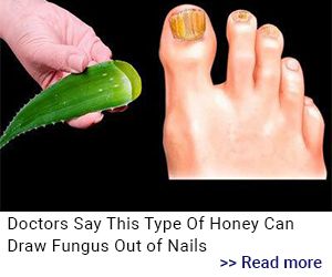 Home Remedies for Yellow Nails