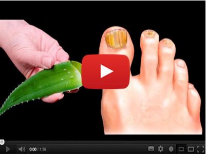 This Sweet Oil + Aloe Vera = Nail Fungus Gone