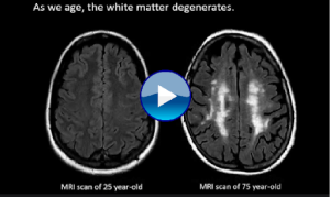 This “10-Second Brain Technique” Unlocks Perfect Memory