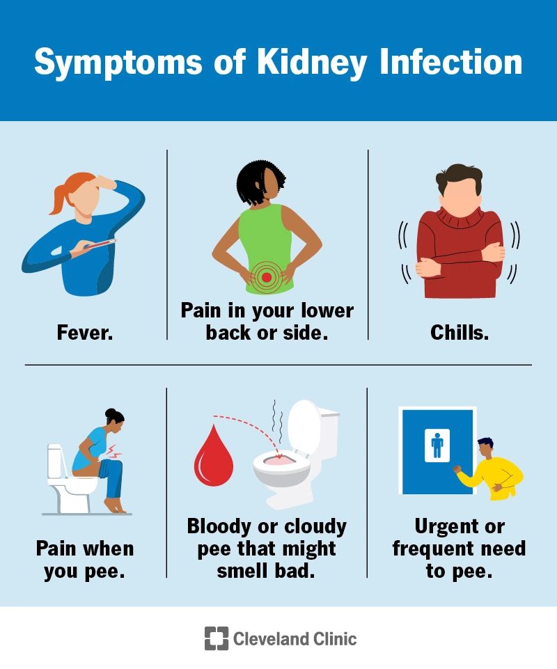 Symptoms of a kidney infection