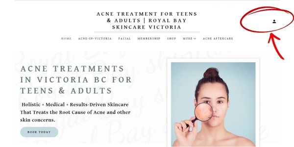 Website for acne treatments in Victoria BC with a user login icon.