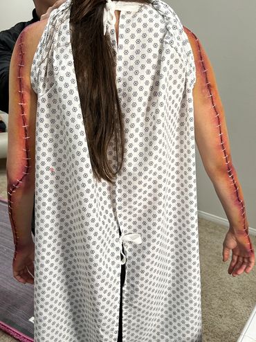 Wound prosthetics on the back of the arms that make them appear stapled shut