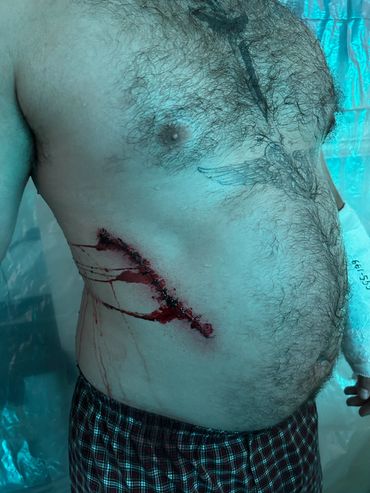 Cartel style stitched kidney removal wound for feature film "Ordinary Madness"