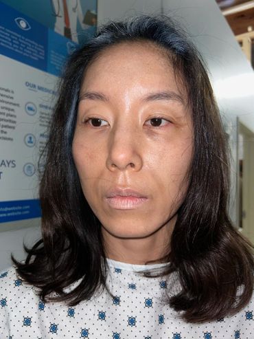 An aged and sickly looking women using makeup
