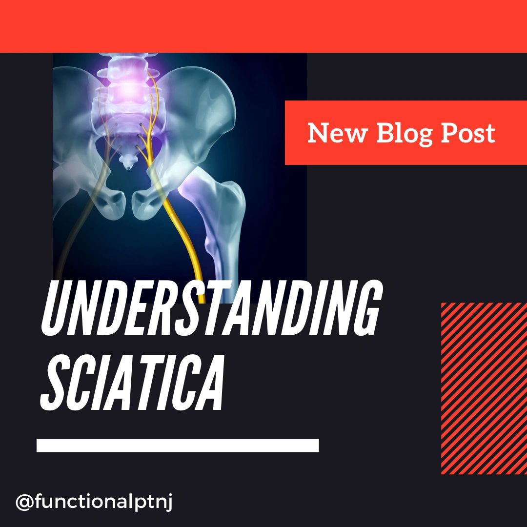 Understanding Sciatica