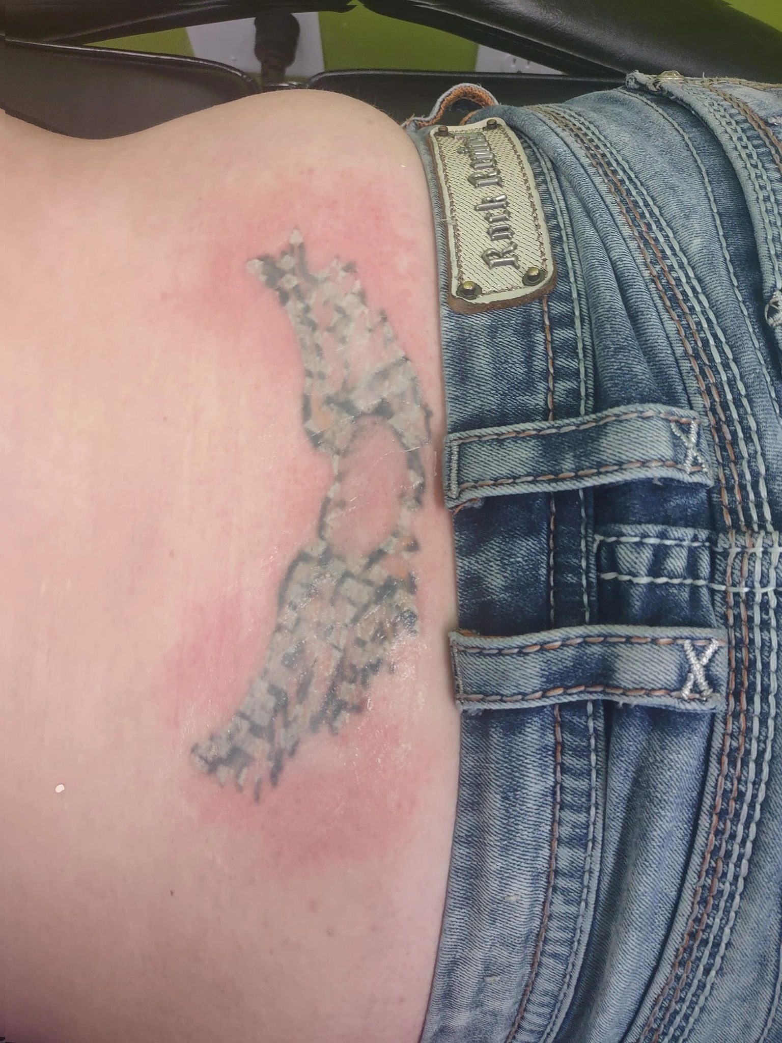 "Demystifying Laser Tattoo Removal How Does It Work?"