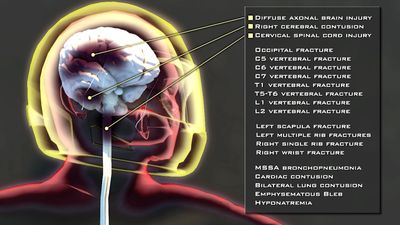 Medical Illustration