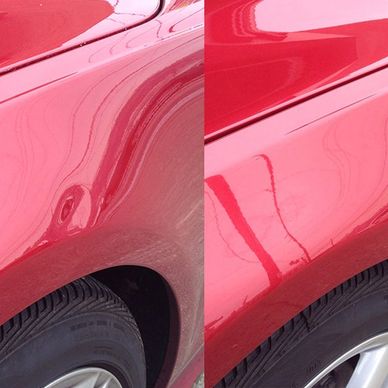 Dent Removal 