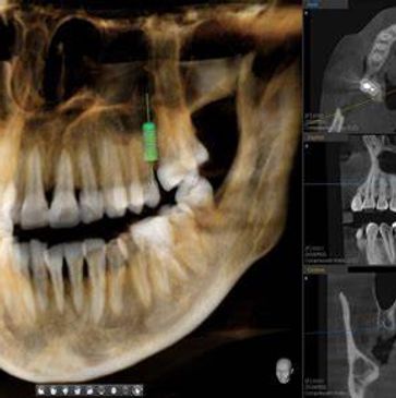 3D CONE BEAM CT IMAGE