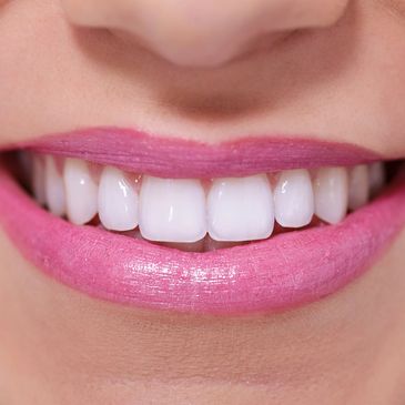 BRIGHT WHITE SMILE