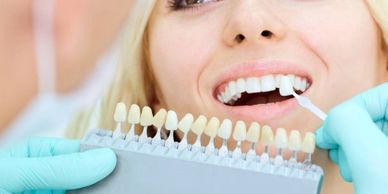 Teeth whitening