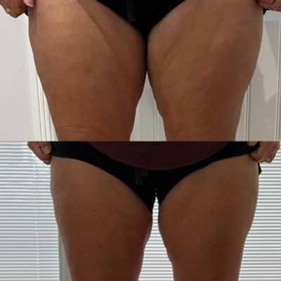 Two photos of thighs