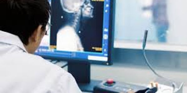 Radiologist analyzing neck and skull image.