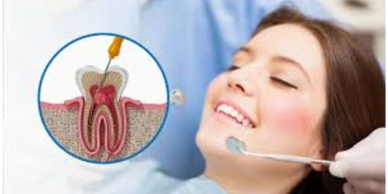 A woman smiling at the dentist with an illustration of root canal treatment.