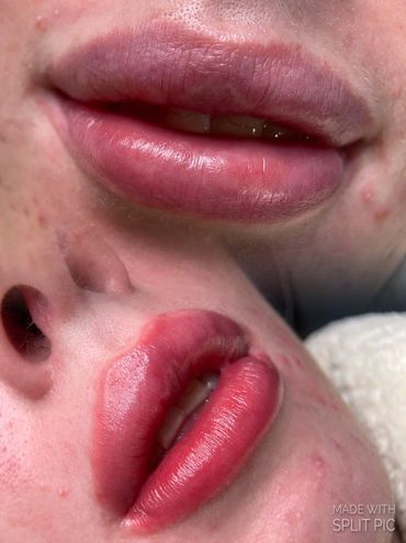 Lip Blush Tattoo