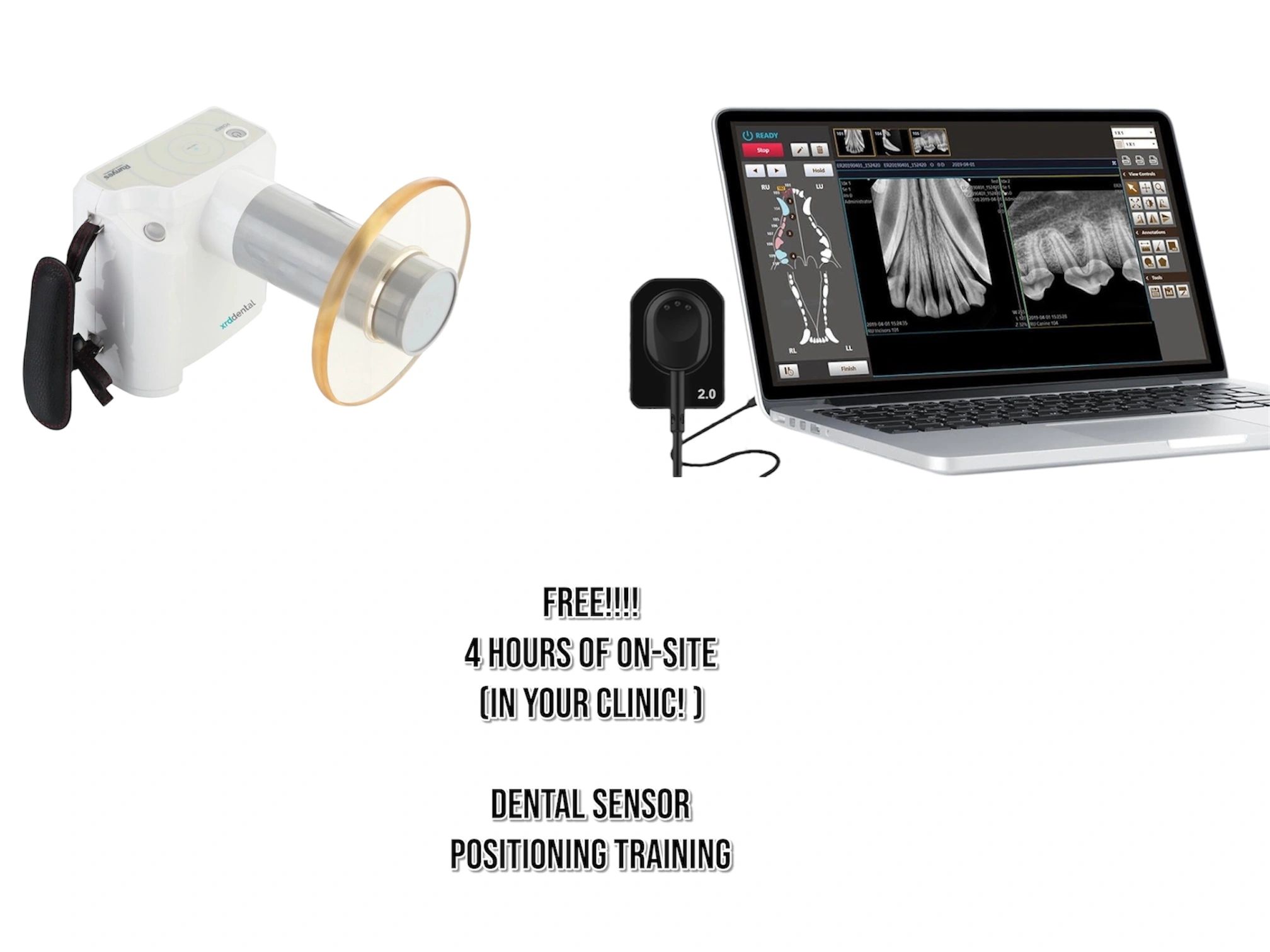 A Case for Full-Mouth Dental Radiographs