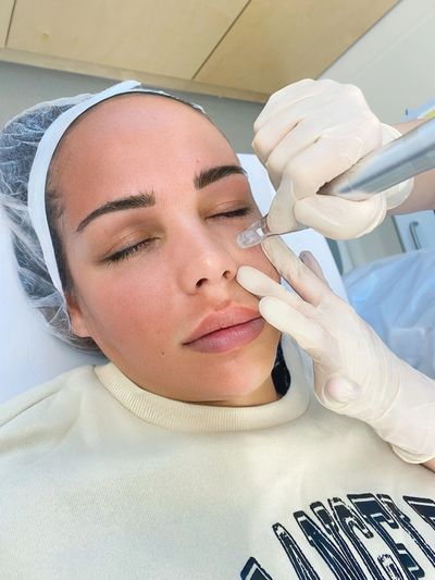 face-treatment-microneedling.jpg