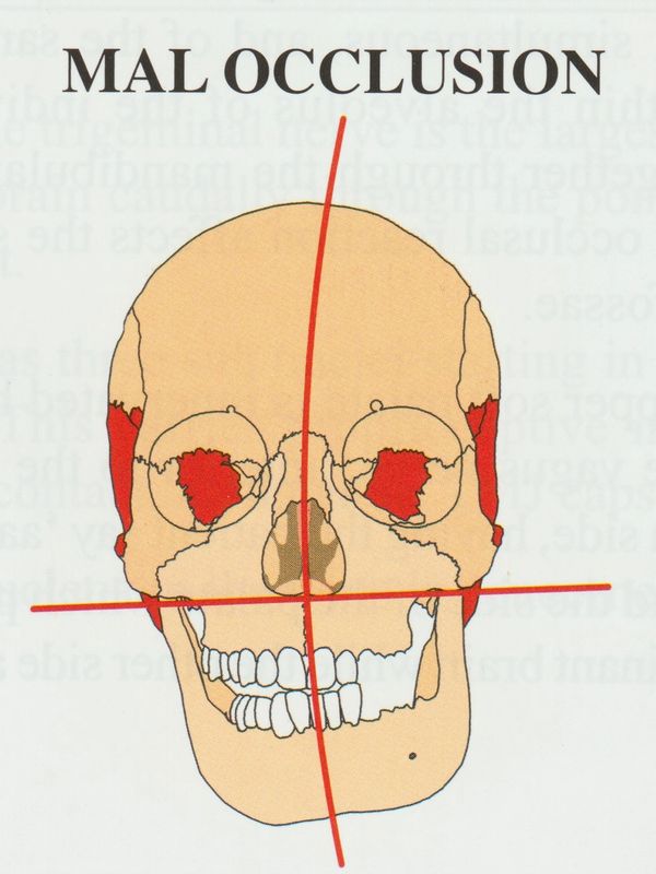 Ratios
