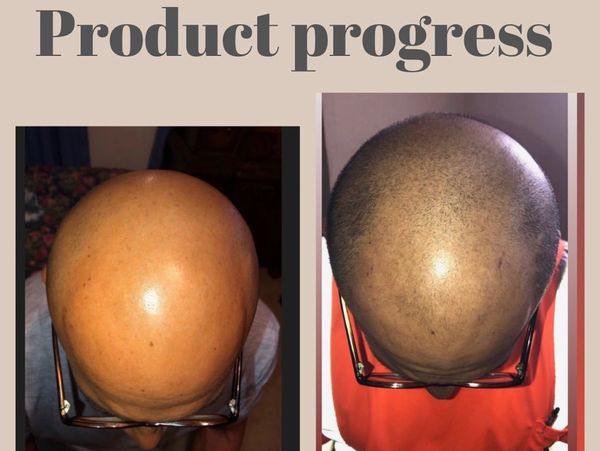 clients hair growth journey