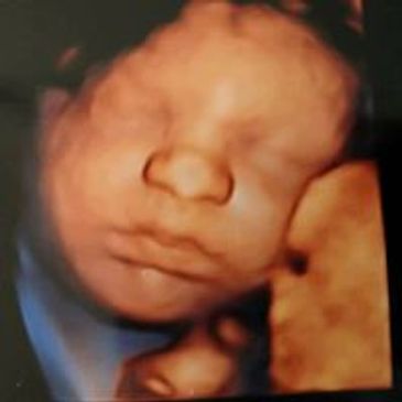 3d Baby Ultrasound Studio In Gastonia 3d Baby Ultrasound Studio