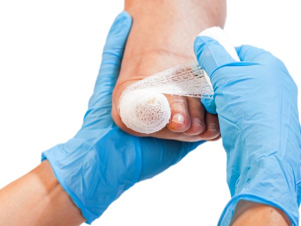 Medical professional bandages injured toe with gauze and tape.