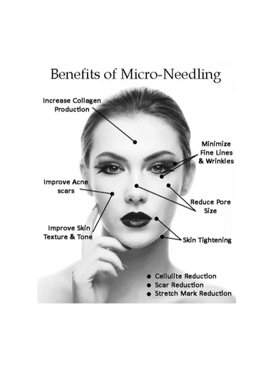 benefits of micro-needling
