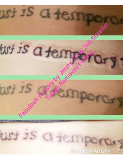Tattoo removal process at FabULash Artistry