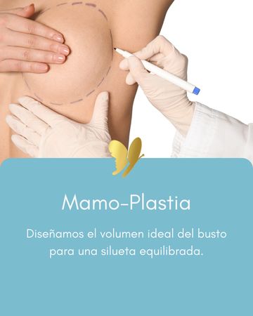 Doctor marking breast for mamo-plasty surgery planning.