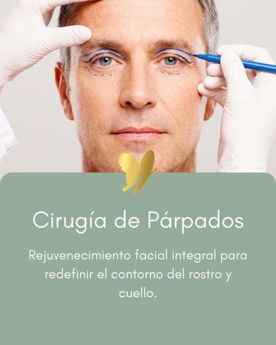 Hombre preparándose para cirugía de párpados con líneas marcadas en los ojos.