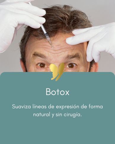 Hombre recibiendo inyección de botox para suavizar líneas de expresión.