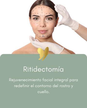 Woman preparing for facelift surgery with facial markings and gloves.
