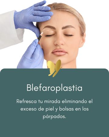 Blepharoplasty procedure to refresh eyes by removing excess skin and bags from eyelids.