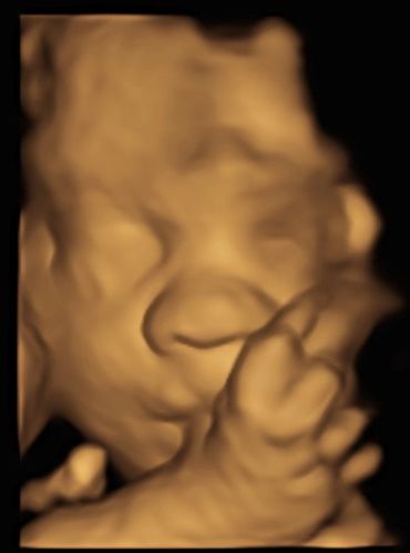 3d-baby-scan-28-weeks-5-days-baby-scan-oldham