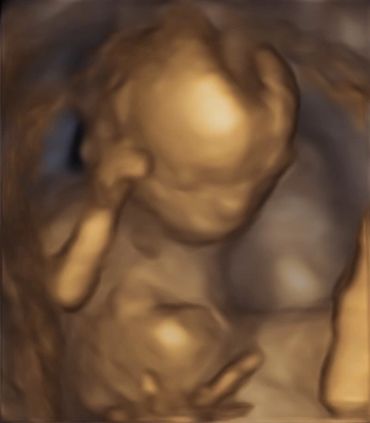 3D-sneaky peek-gender scan 