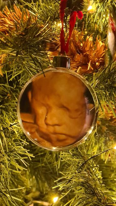 baby-scan-bauble