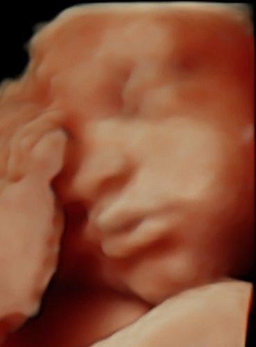3d-baby-scan-bonding-scan-private-scan-oldham-little-miracles-sonography