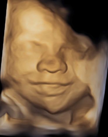 smiley-baby-3d-baby-scan-saddleworth-huddersfield