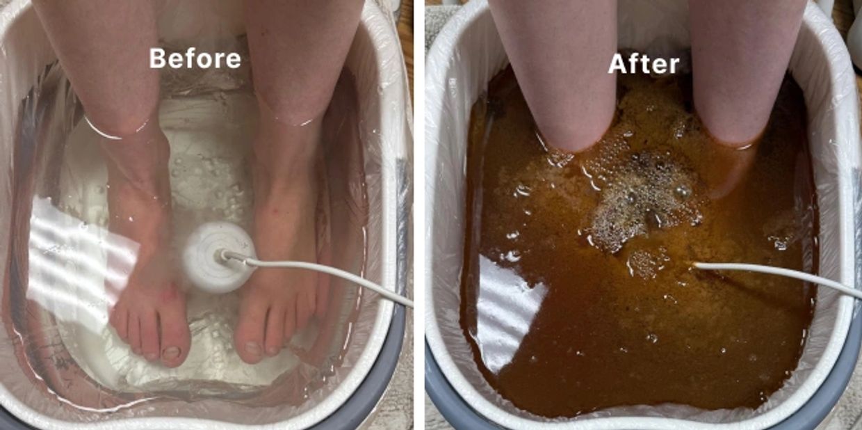 Before and after feet in a footbath