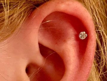 Are Your Earring Backs Causing Pain and Redness? - Blomdahl USA