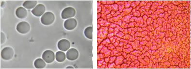 Live and Dry Blood Cell Sample