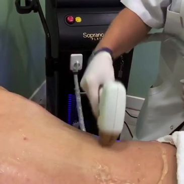 Laser Hair Removal Treatment in Sheridan AR