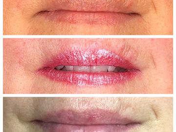 icy lips permanent lip tint linda paradis permanent lips color pain semi permanent lip pigment
