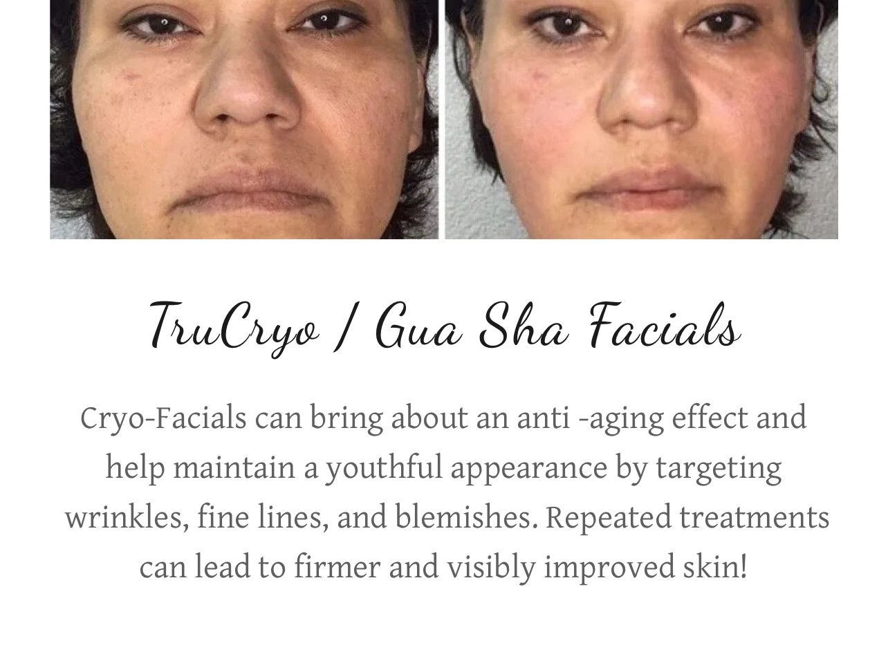 Before and after photos showing TruCryo/Gua Sha facial treatment effects on skin.
