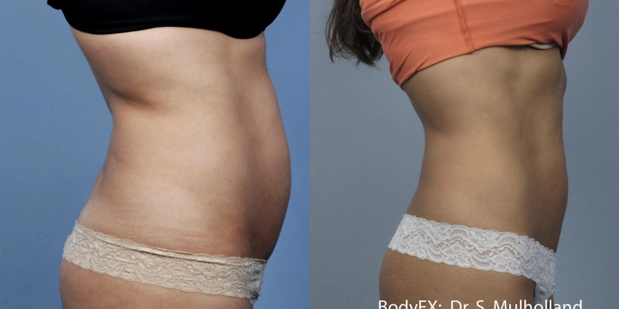 Side-by-side before and after body transformation images.