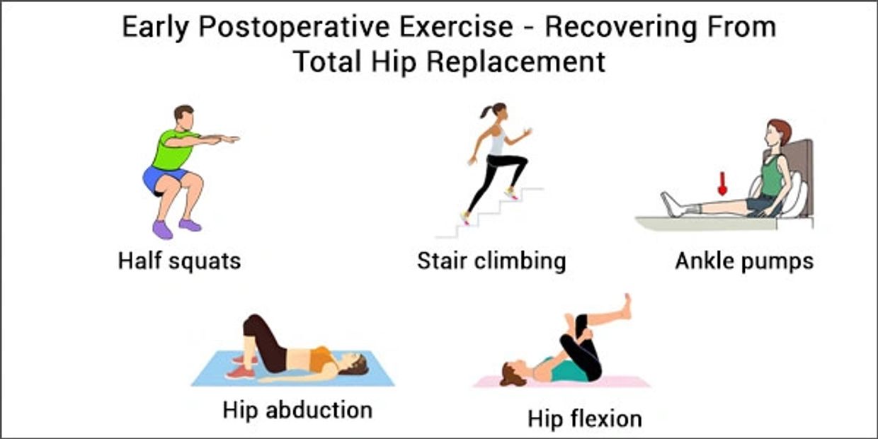 Reduce Pain and Swelling - Total Hip Replacement Exercise Guide -  Sunnybrook Hospital