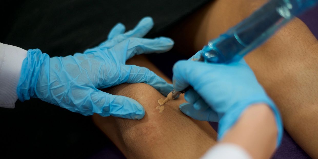 Applying tattoo on a person's leg with gloves on.
