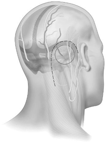 Neurosurgery and Spine Care - Jose R. Reyes Memorial Medical